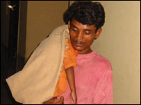 दिमाग़ी बुख़ार के मरीज़