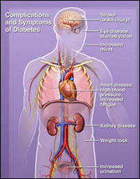 شکر(  ډيابېټ )