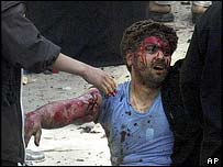 يک مجروح بمبگذاری های سال 2004 در کربلا