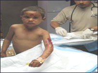 Uruzgan'daki saldırıda yaralanan çocuk