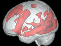 मस्तिष्क 