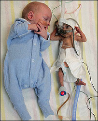 जुड़वाँ लेकिन एक तीन गुना बड़ा और भारी भी