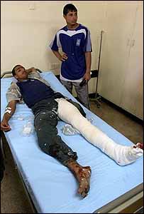 Ferido no atentado de sábado em Bagdá