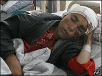 یک زخمی انفجار بغلان