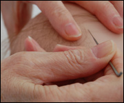 Each hair is attached individually