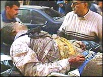 एक घायल व्यक्ति