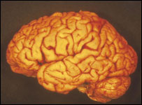 Cérebro humano