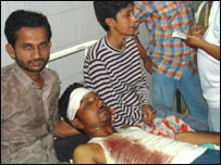 गोरखपुर धमाके में घायल