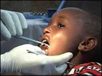 Masai child receiving dental treatment