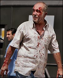 يک مجروح عراقی