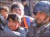 घायल प्रदर्शनकारी