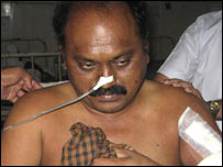     ممبئی ہسپتال