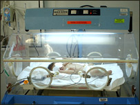 نوزاد در حال معالجه در بيمارستان