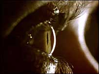 Professor Andrew Lotery