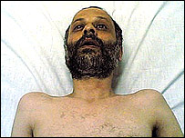 عکسی که در سايتهای اينترنتی منتشر شده و ظاهرا آقای گنجی را در چهل و ششمين روز اعتصاب غذا نشان می دهد