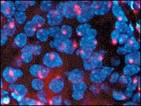 Crescimento da diabetes é global