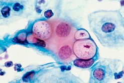 Image: chlamydia (Photo: National Cancer Institute)