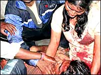 विस्फोट का शिकार एक युवक