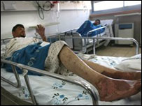 İsrail'de tedavi edilen Filistinli