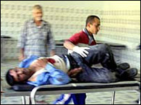 مجروح عراقی