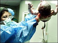 नवजात बच्चा