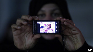 بحرينية تظهر صورة جريح في المظاهرات