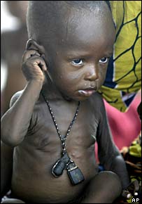 Trẻ em suy dinh dưỡng ở trụ sở của Tổ chức Bác sỹ Không Biên giới tại Maradi, Niger