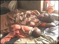 उड़ीसा में हैजे के मरीज़