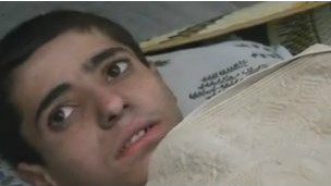 تصاویر ویدئویی که توسط فعالان مخالف دولت منتشر شده، یک پسر جوان علوی را نشان می‌دهد که از حوادث روستای عقرب، جان سالم به در برده است.