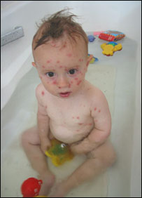 په کڅوک اخته ماشوم