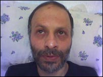 عکسی که در سايتهای اينترنتی منتشر شد و اکبر گنجی را ظاهرا طی دوران اعتصاب غذا در زندان اوين نشان می دهد