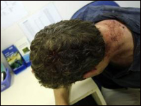 Tấm ảnh được đưa làm bằng chứng về việc ông Stocking bị đánh