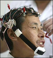 Một nô lệ được chữa trị tâm thần sau khi được giải cứu