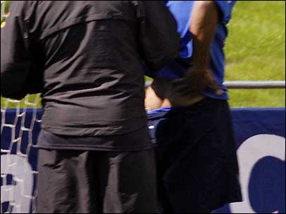 Ronaldinho mostra a contusão