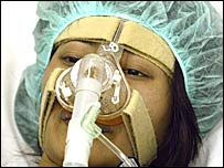 'बर्ड फ़्लू'  से पीड़ित एक मरीज़