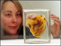 बोतल में बंद दिल ( साभार: वेलकम ट्रस्ट)