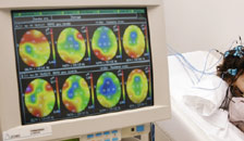 a brain scan on a computer