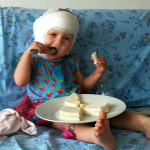 Evie, após a cirurgia que restaurou sua audição (Arquivo pessoal)