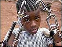 Sierra Leone'da savaş mağduru bir çocuk
