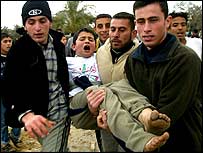 हमले में घायल एक बच्चा