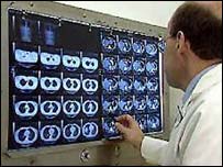 Médico observando radiografias