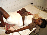 घायल शंकर