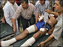 Saldırıda yaralanan bir kişi