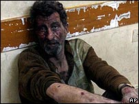 مجروح عراقی 