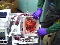 Coração é ligado a máquina em vez de preservado em gelo, como no sistema convencional