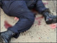 دھماکہ کا شکار پولیس اہلکار