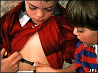 Criança com diabetes