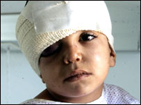  تازہ ترین اسرائیلی حملوں میں مرنے والوں کی تعداد تیس سے زائد ہوگئی ہے۔   