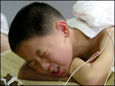 一個在接受中醫治療的孩子