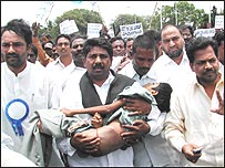 दिल के मरीज़ बच्चों का हैदराबाद में प्रदर्शन